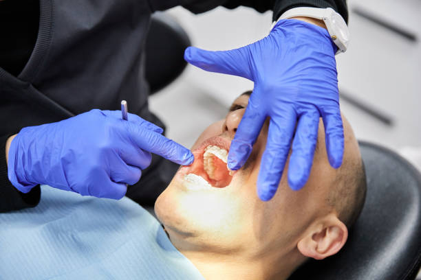 Best Chipped Tooth Repair Near Me  in Citrus Springs, FL